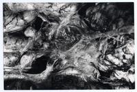 Membrana de la base del cerebro