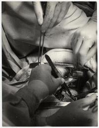 [Equipo médico durante una intervención quirúrgica]