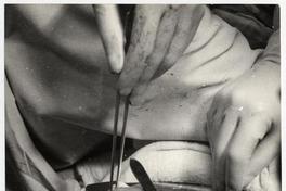 [Equipo médico durante una intervención quirúrgica]