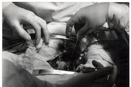 Operación al corazón, doctores Borzone y Escobar, Hospital El Salvador