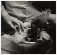 Operación al corazón, doctores Borzone y Escobar, Hospital El Salvador