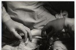 Operación al corazón, doctores Borzone y Escobar, Hospital El Salvador